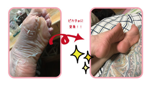Baby Foot